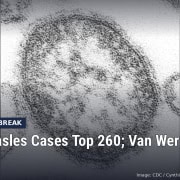 Fostoria News: Electron microscope image of a measles virus particle, with headline: Ohio Measles Cases Top 260; Van Wert County Added